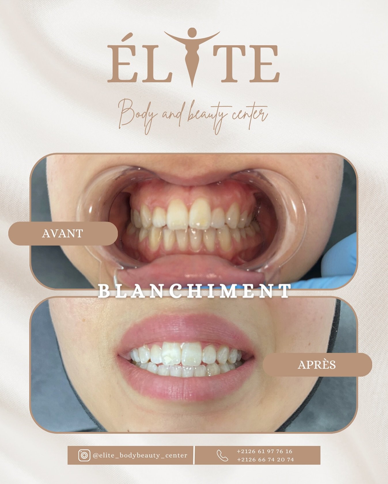 ELITE BODY AND BEAUTY CENTER