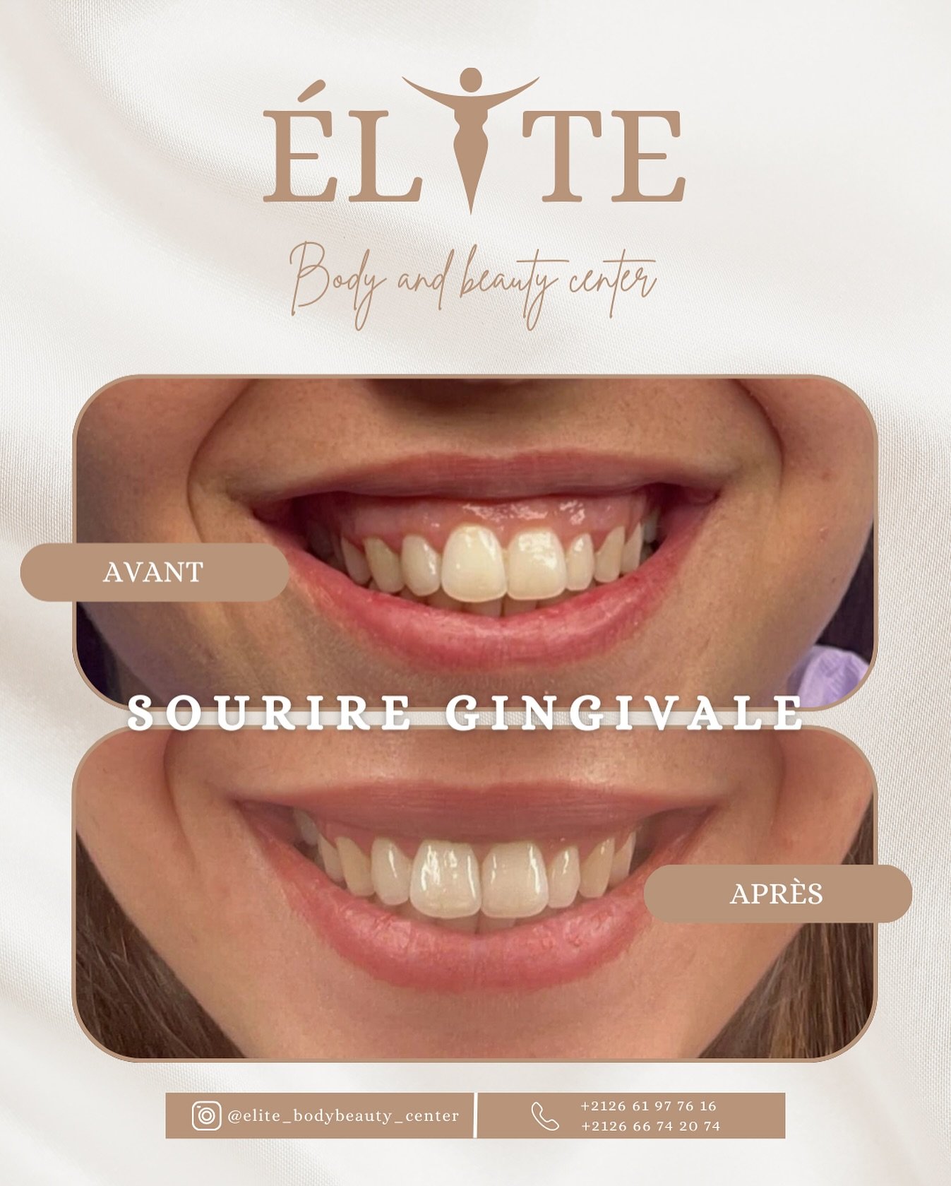 ELITE BODY AND BEAUTY CENTER