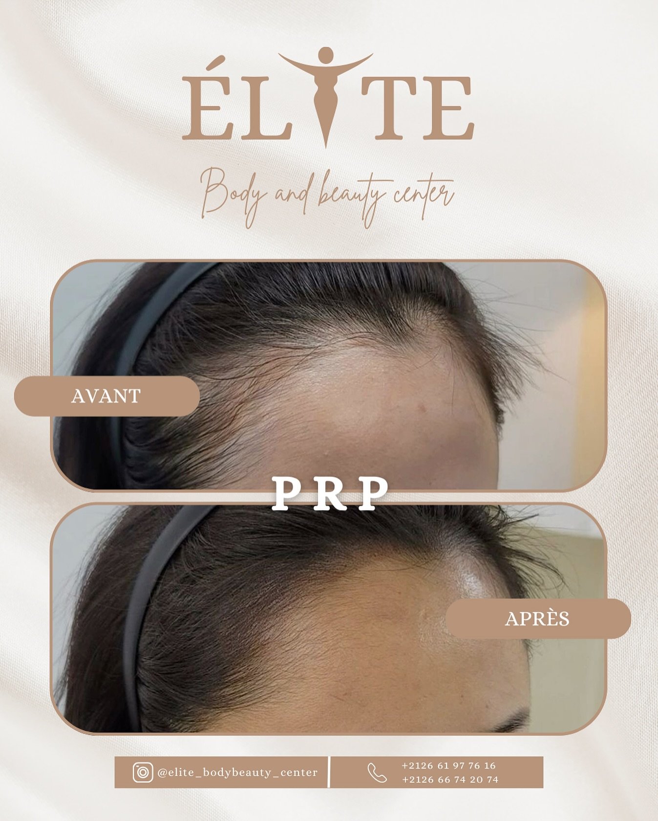 ELITE BODY AND BEAUTY CENTER