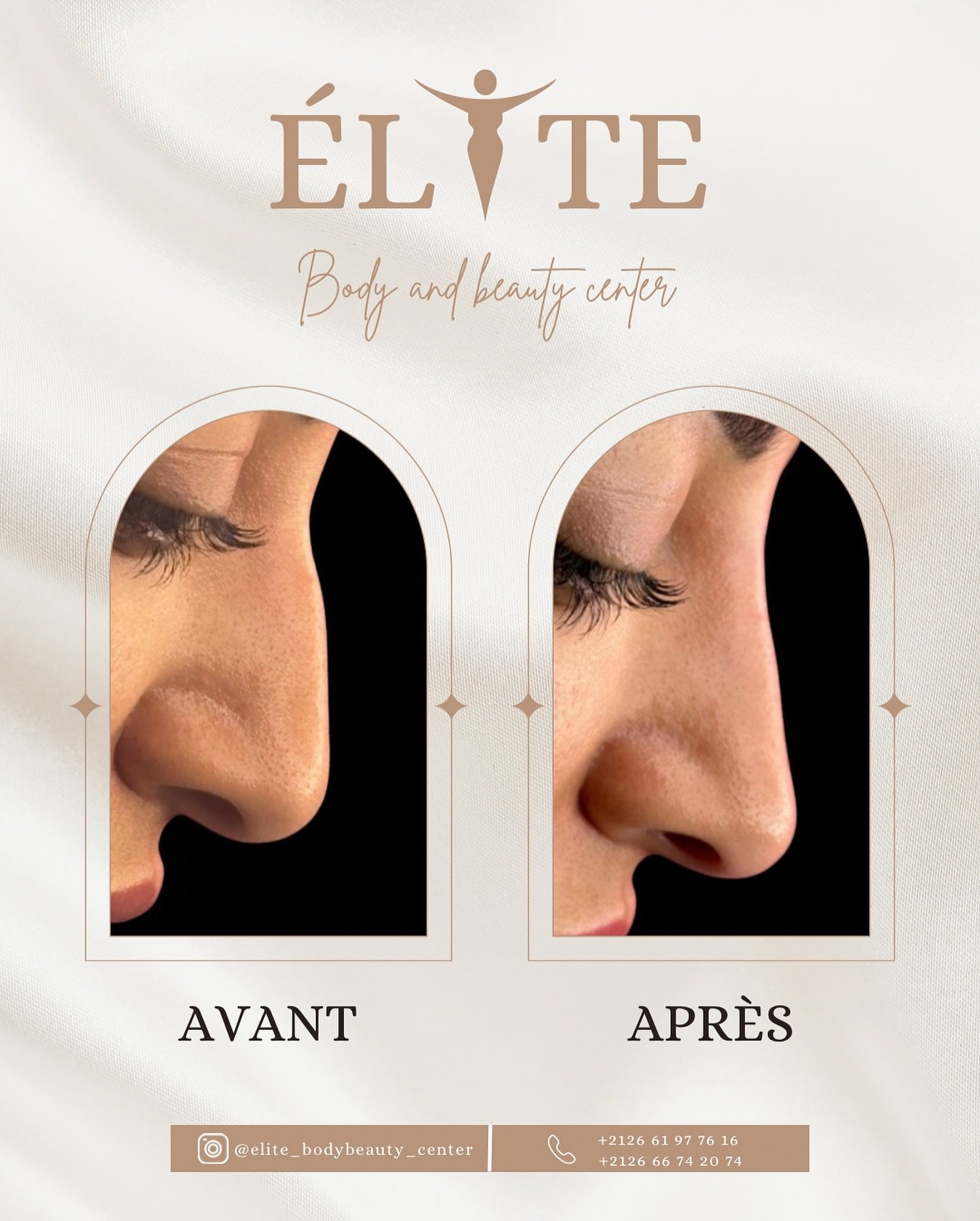 ELITE BODY AND BEAUTY CENTER