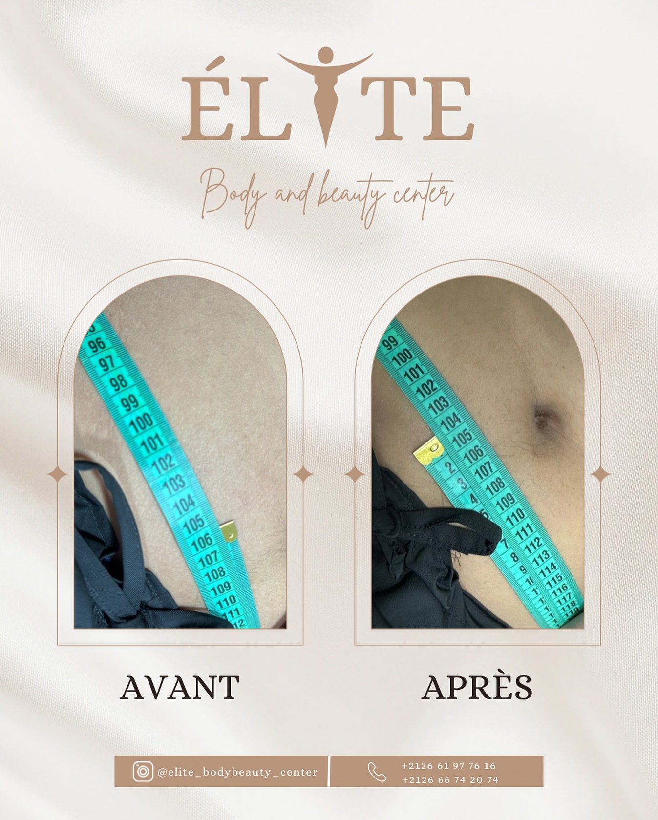 ELITE BODY AND BEAUTY CENTER