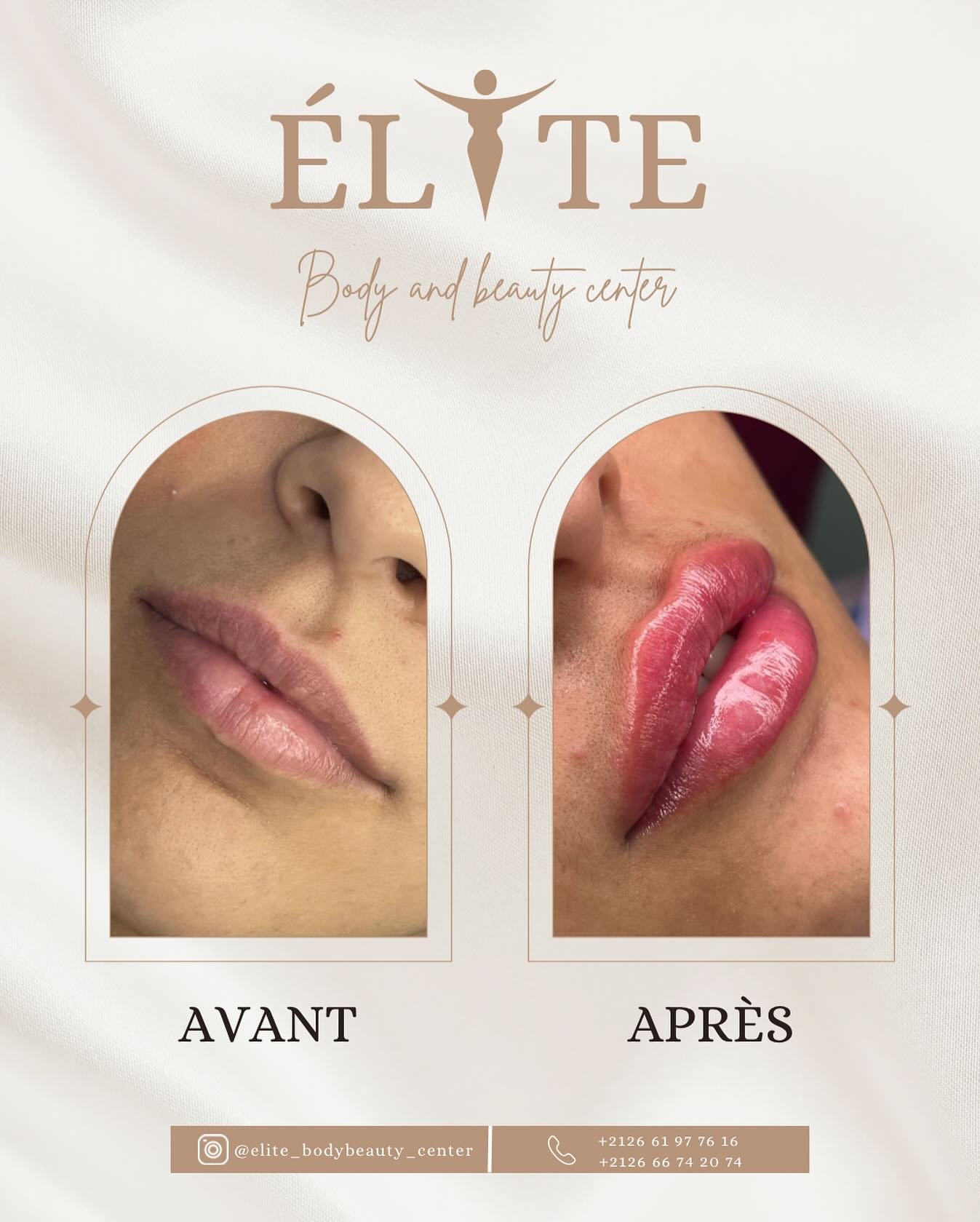 ELITE BODY AND BEAUTY CENTER