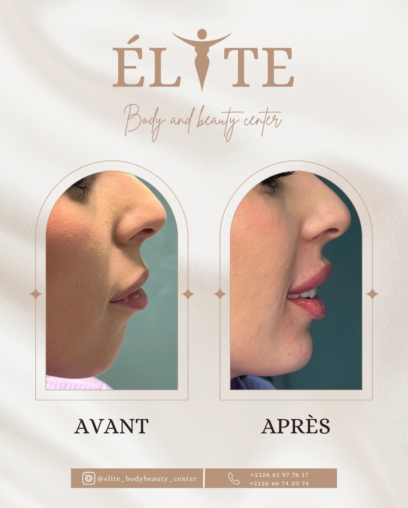 ELITE BODY AND BEAUTY CENTER