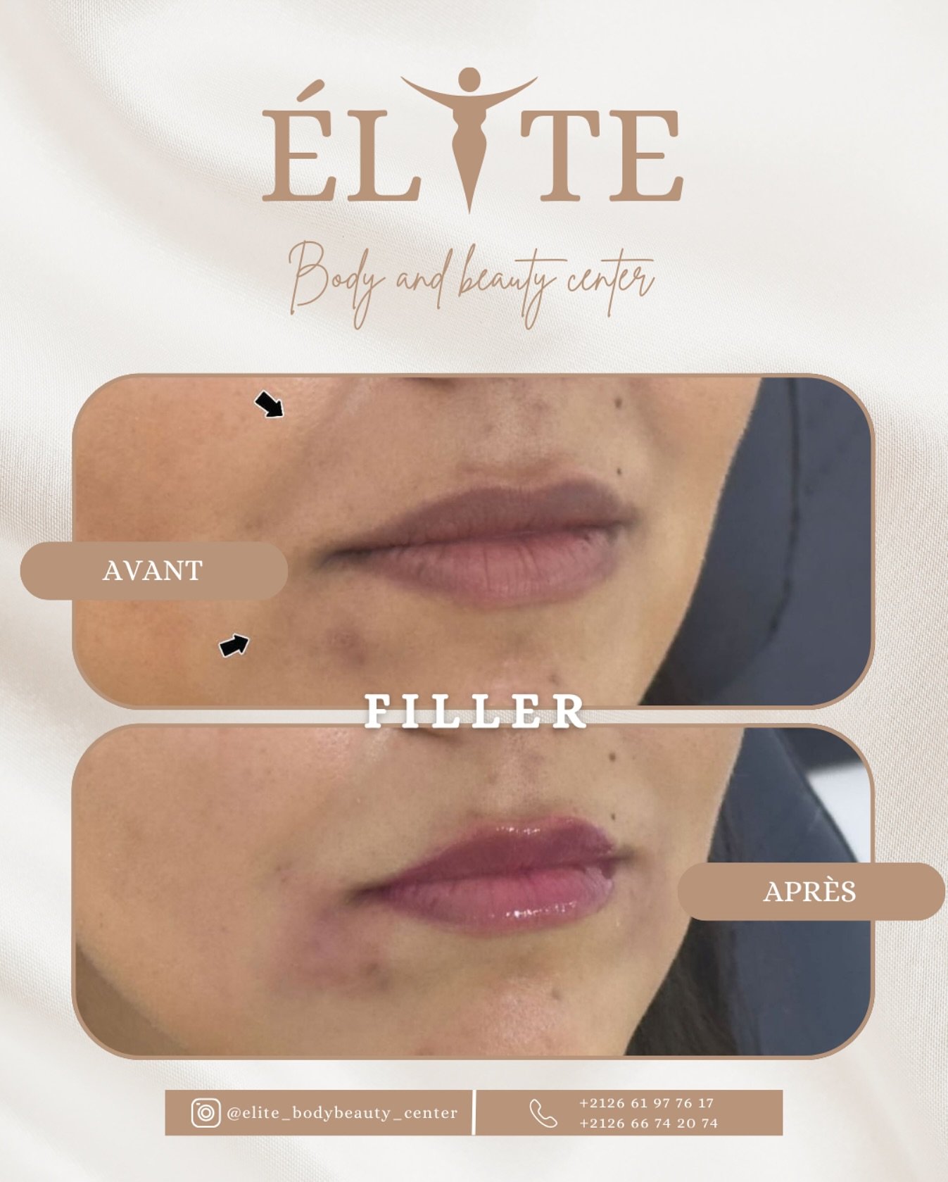 ELITE BODY AND BEAUTY CENTER