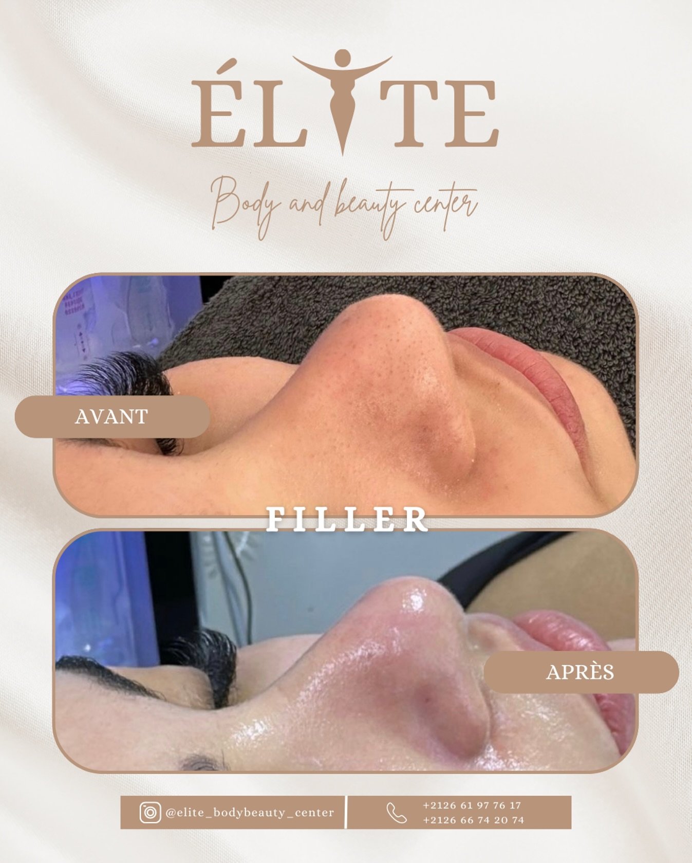 ELITE BODY AND BEAUTY CENTER